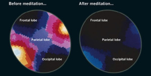 meditation-brain