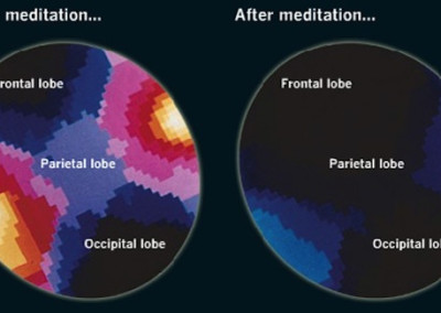 Have You Tried Meditation?    Why You Should Consider It…